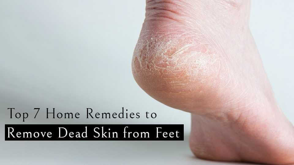 Top 7 Home Remedies to Remove Dead Skin from Feet