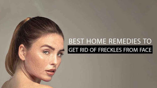 Best Home Remedies To Get Rid Of Freckles from Face - Vince