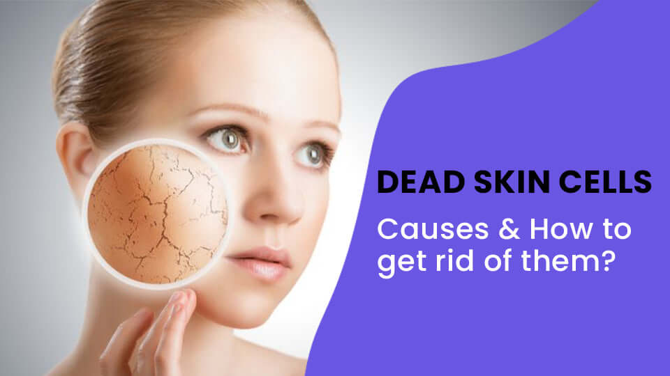 What are the Causes of Dead Skin Cells & How to get Rid of Them