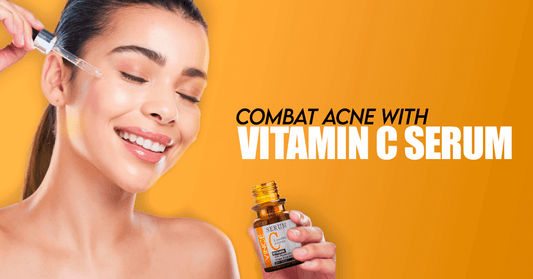 Combat Acne with Vitamin C Serum