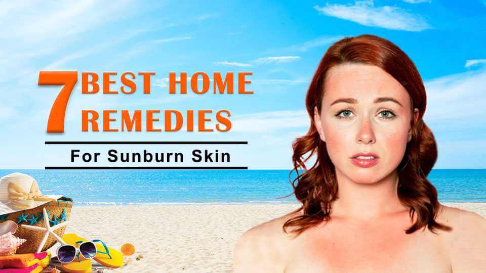 7 Best Home Remedies For Sun Burn Skin
