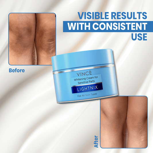 Before and After Result of Using Sensitive Areas Brightening Cream
