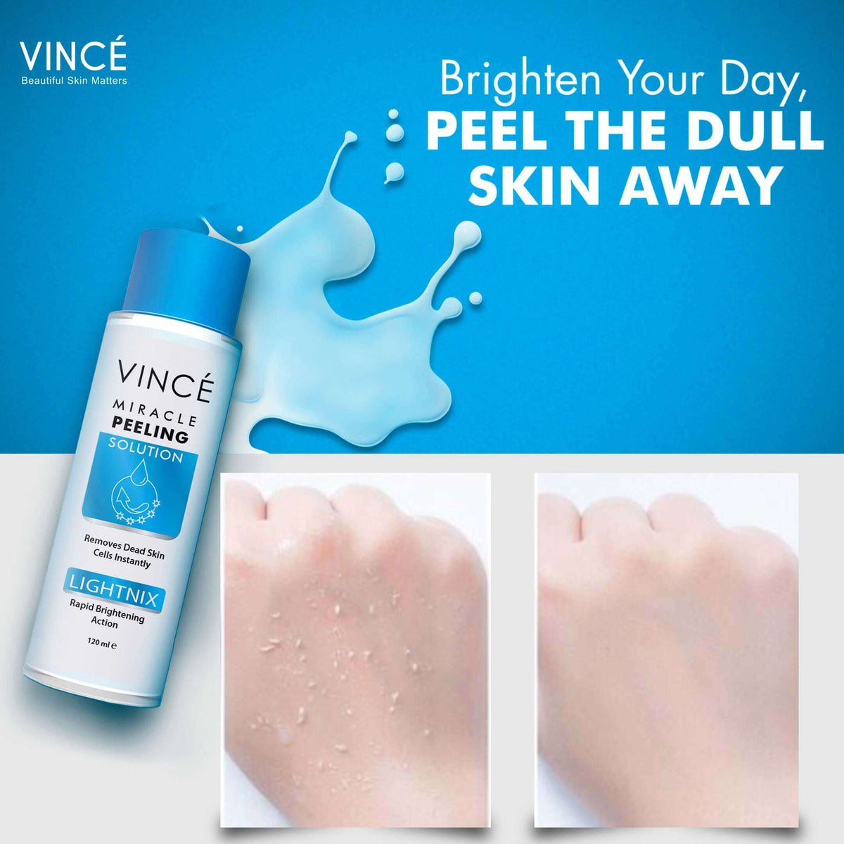 Vince Miracle Peeling Solution 120ML