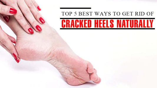 Top 5 best ways to get rid of cracked heels