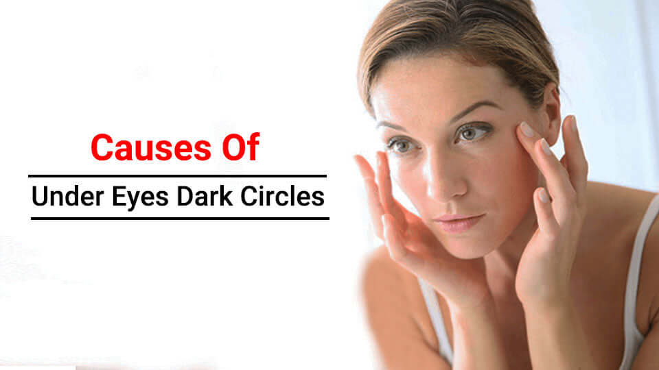 Causes Of Under Eyes Dark Circles