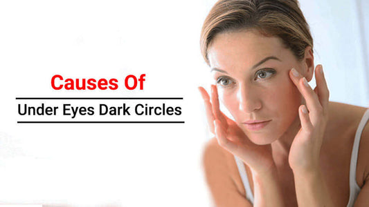 Causes of under eyes dark circles