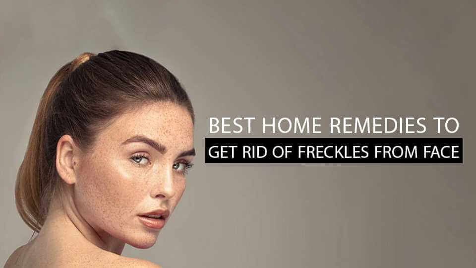 Best Home Remedies To Get Rid Of Freckles from Face
