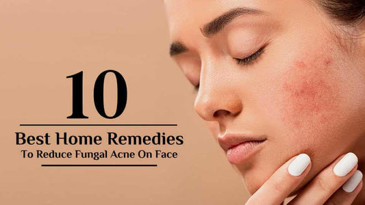 10 best home remedies to reduce fungal acne on face