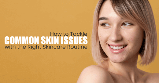 How to Tackle Common Skin Issues with the Right Skincare Routine