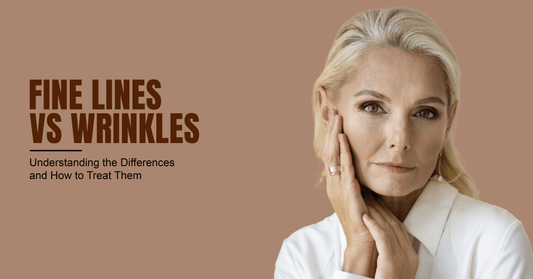 Fine Lines vs. Wrinkles Understanding the Differences and How to Treat Them