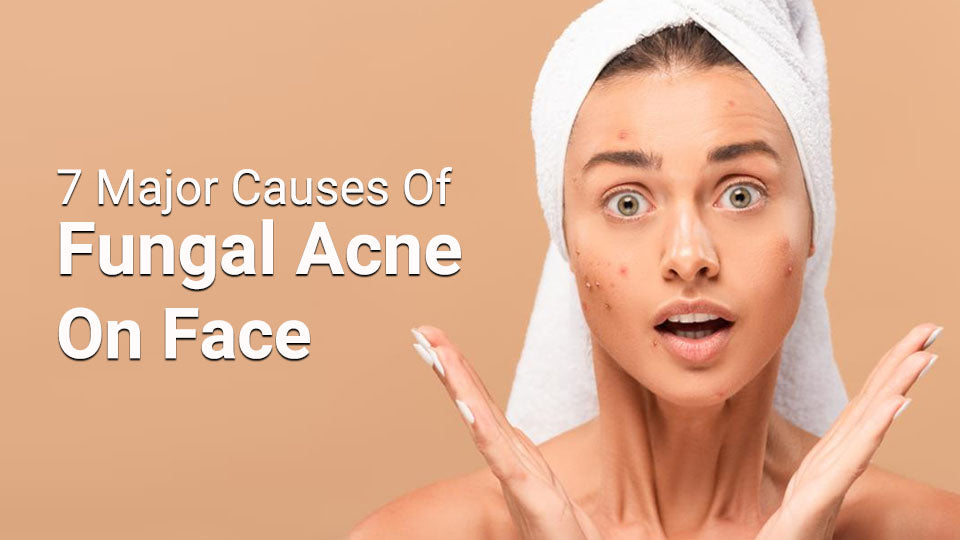 7 Major Causes of Fungal Acne on Face
