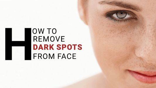 How to remove dark spots from face