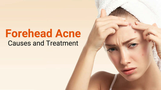 Forehead acne causes and treatments