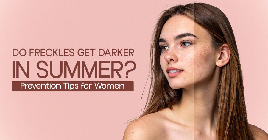 Do Freckles Get Darker in Summer Prevention Tips for Women