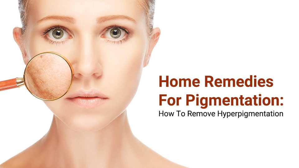 Home Remedies for Pigmentation (How to Remove Hyperpigmentation)