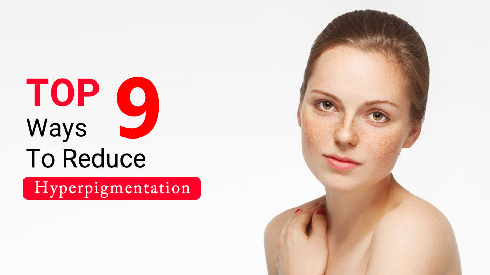 Top 9 Ways to Reduce Hyperpigmentation