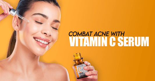 Combat Acne with Vitamin C Serum