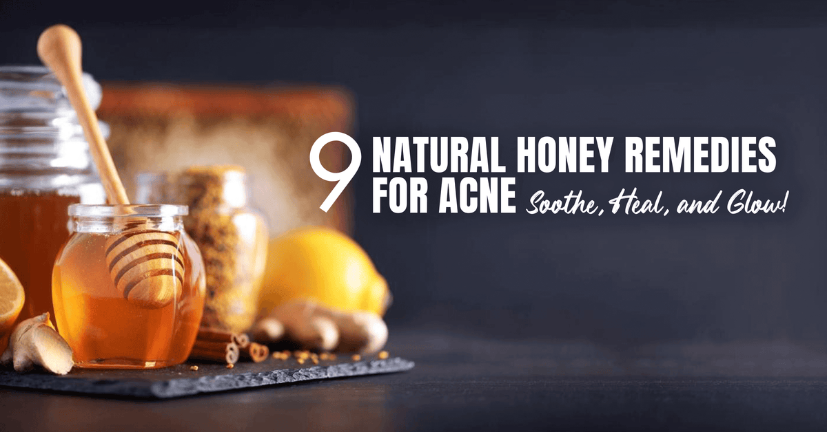 9 Natural Honey Remedies for Acne
