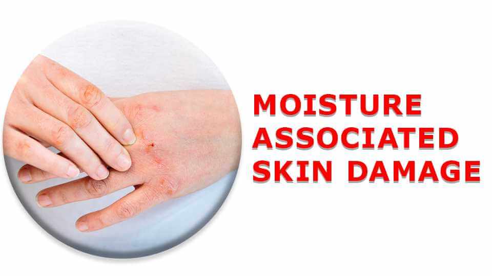 Best Treatment for Moisture Associated Skin Damage
