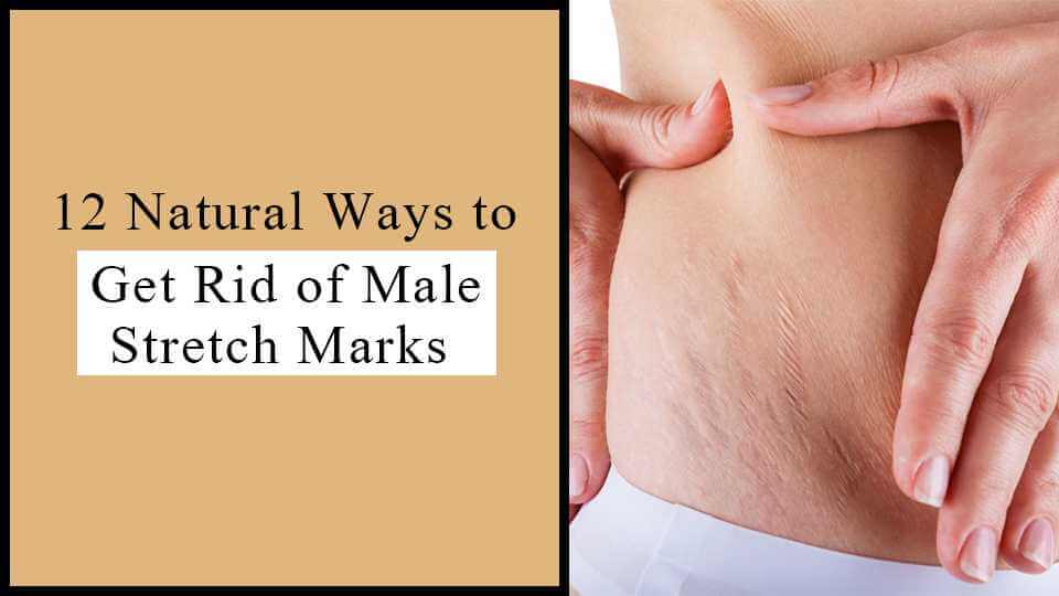 12 Natural Ways to Get Rid of Male Stretch Marks - Vince Care