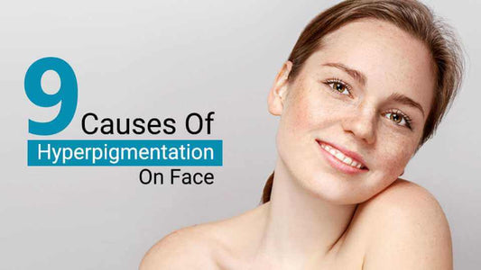 9 causes of hyperpigmentation on face