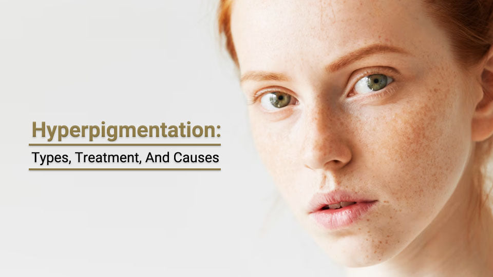 Hyperpigmentation: Types, Treatment And Causes