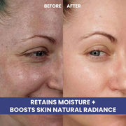 Hyaluronic Acid Serum Before / After