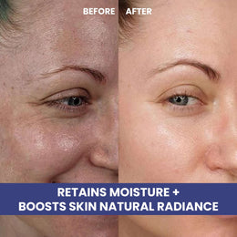 Hyaluronic Acid Serum Before / After