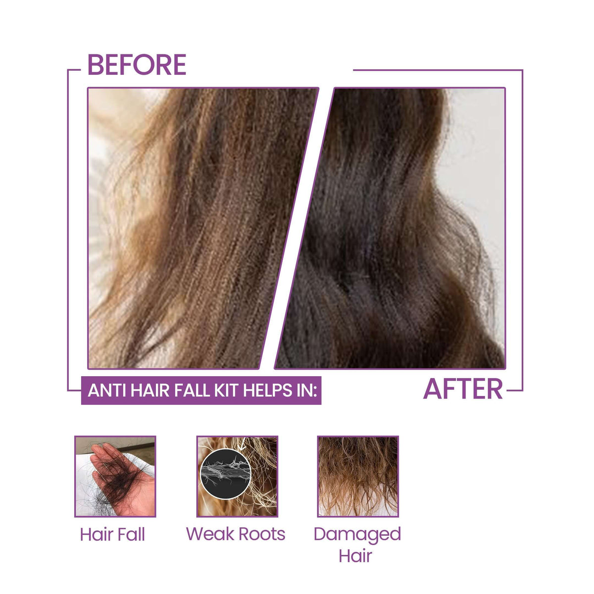 Anti Hair Fall Kit Before / After