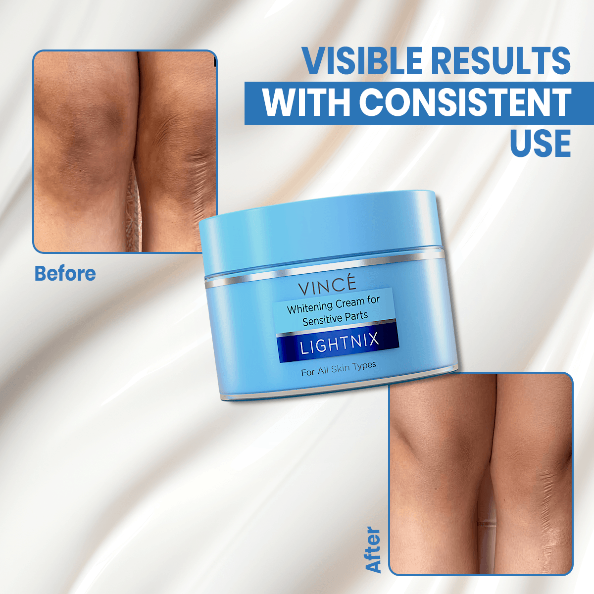 Before and After Result of Using Sensitive Areas Brightening Cream