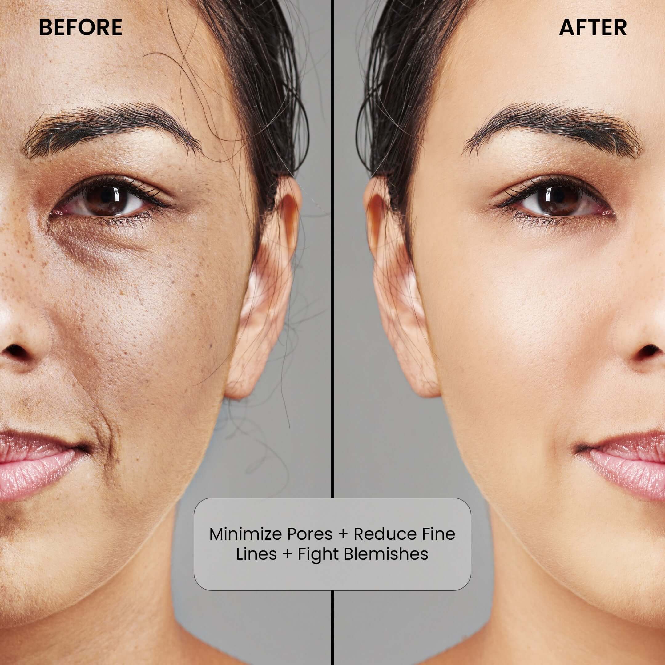 Niacinamide Before and After