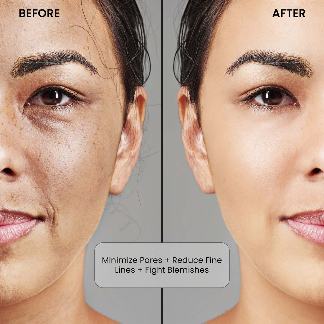 Niacinamide Before and After