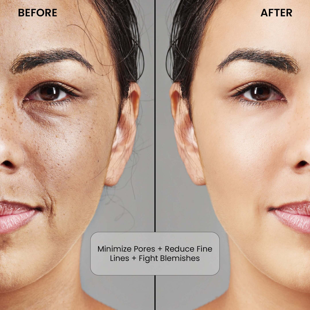 Niacinamide Before and After