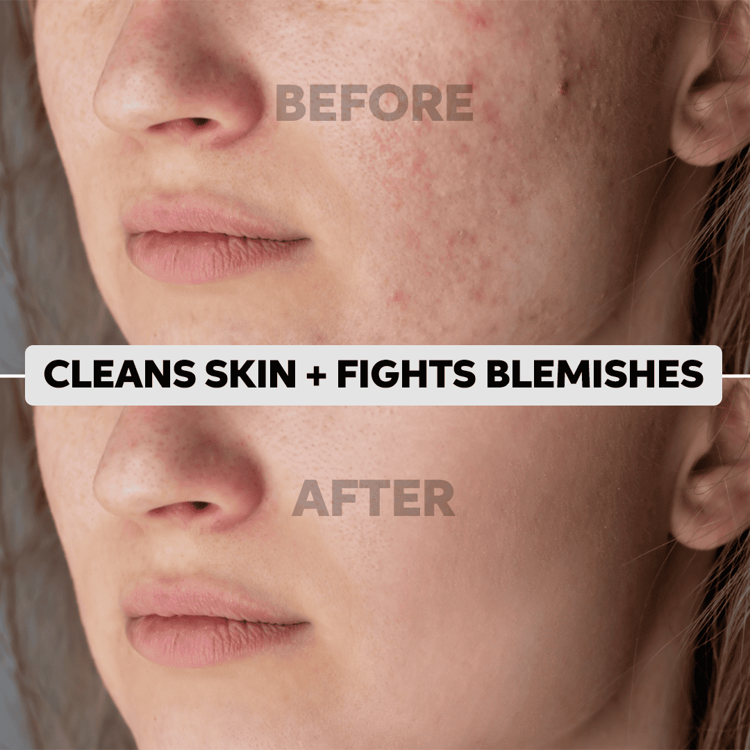 Clean & Bright Miracle Kit Results