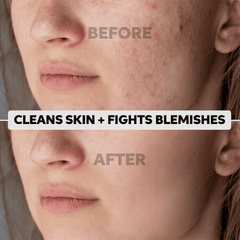 Clean & Bright Miracle Kit Results