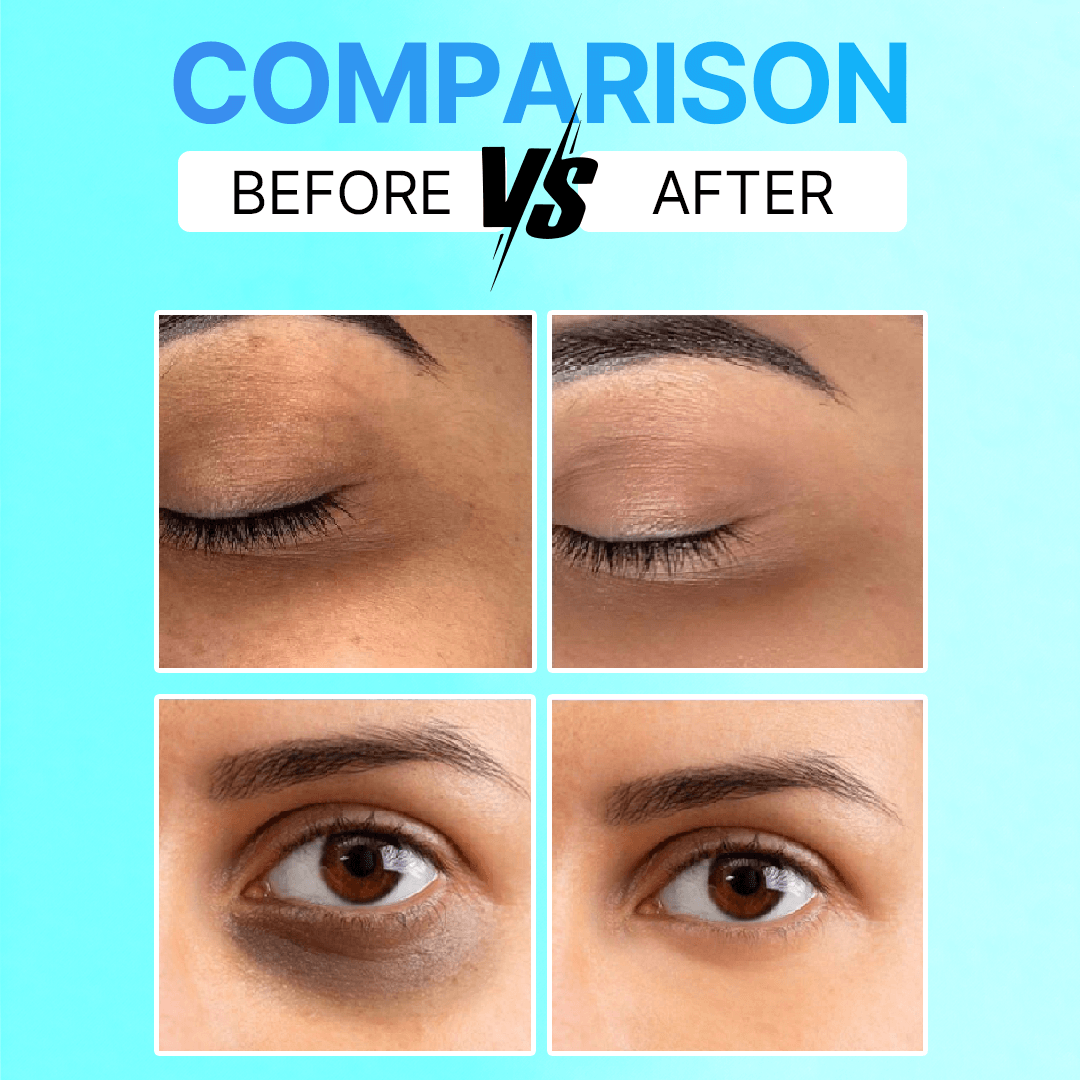 Eye Recovery Serum For Dark Circles Before and After