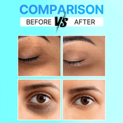 Eye Recovery Serum For Dark Circles Before and After
