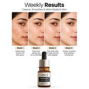 Niacinamide Result