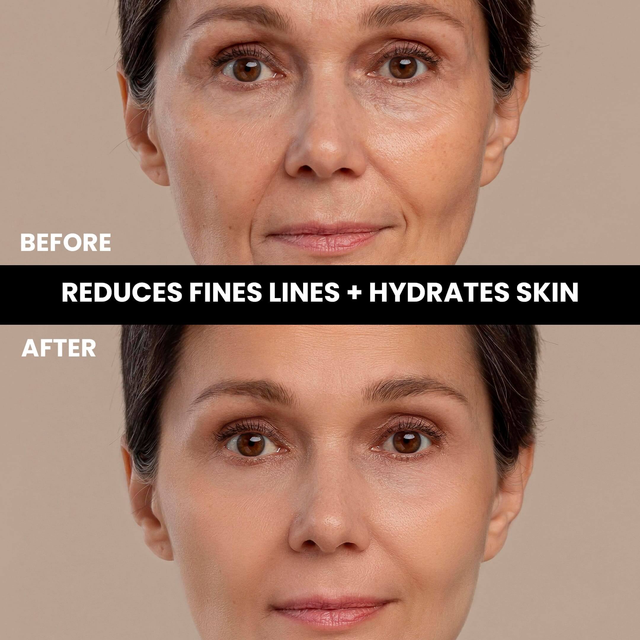 Retinol Serum Before and After