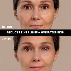 Retinol Serum Before and After