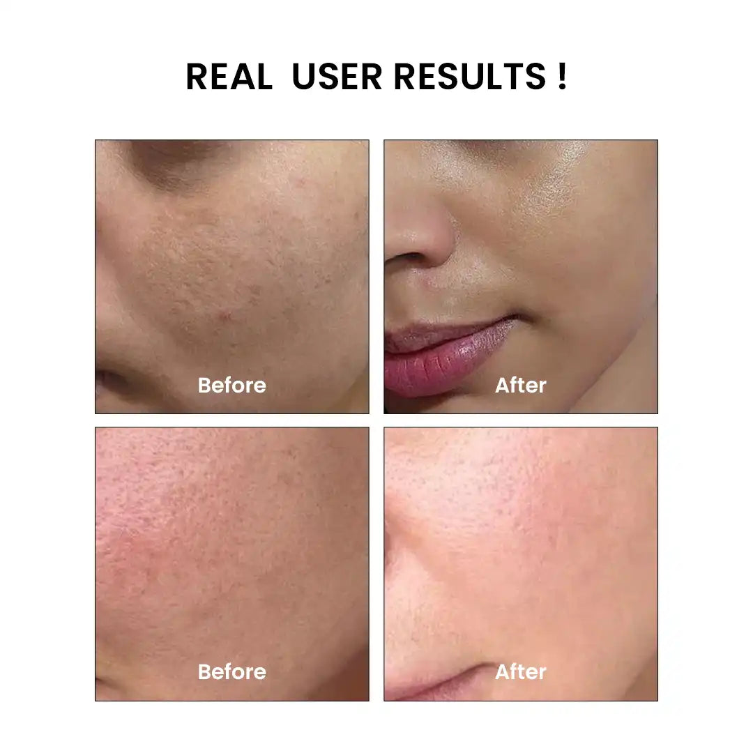 Rice Glass Glow Kit - Before and After