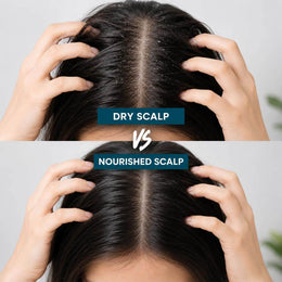 Scalp Xpert Anti Dandruff Shampoo by VINCE