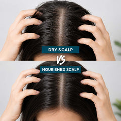 Scalp Xpert Anti Dandruff Shampoo