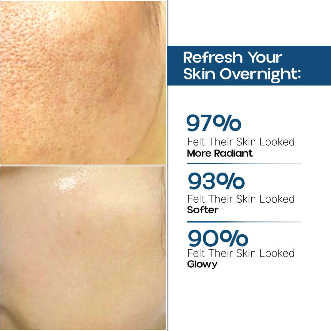 Skin Lightening Night Cream Before and After