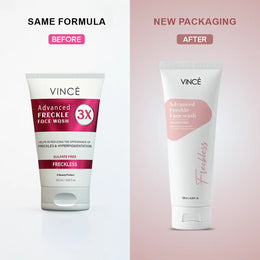 VINCE Advanced Freckle Face Wash (OLD-NEW)