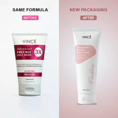 VINCE Advanced Freckle Face Wash (OLD-NEW)