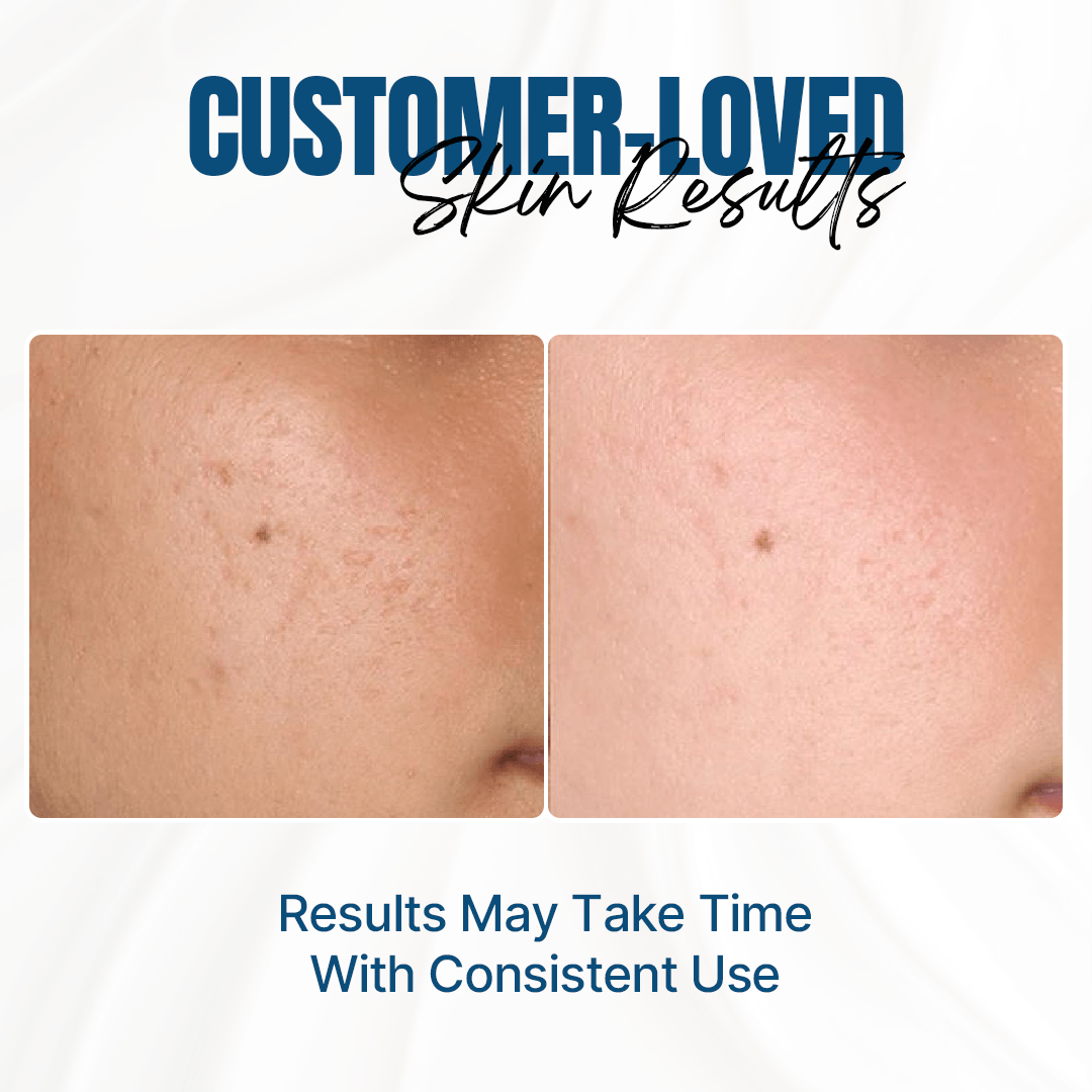 Multi-Level Moisturizing Cream Before / After