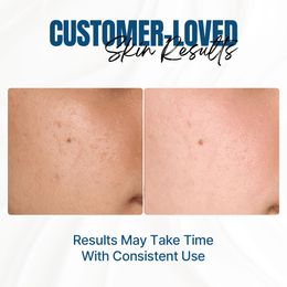 Multi-Level Moisturizing Cream Before / After