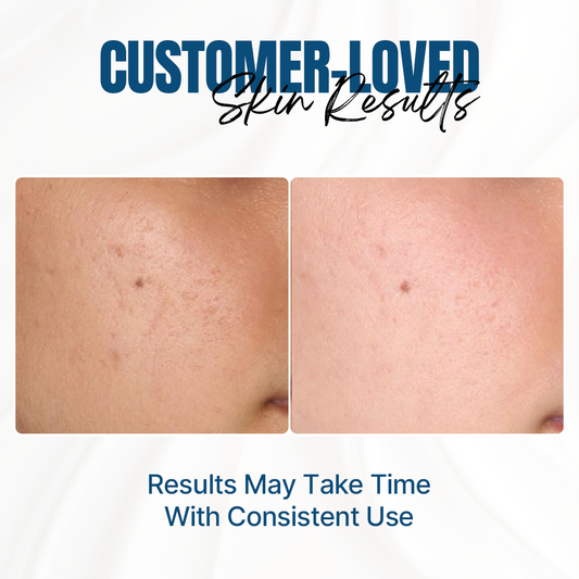 Multi-Level Moisturizing Cream