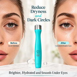 VINCE Ultra Correct Eye Roller - Before & After